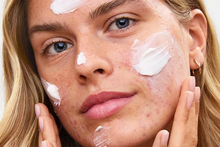 Navigating Alpha Hydroxy Acids for Sensitive Skin