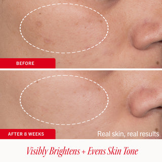 Dark Spot Serum with Niacinamide
