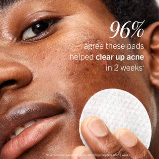 Ultimate Acne Solutions Routine
