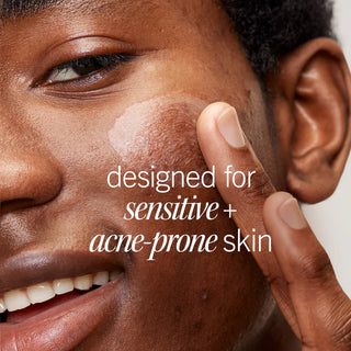 Ultimate Acne Solutions Routine