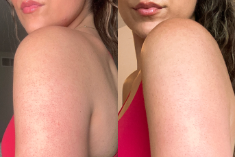 Real Skin, Real Results