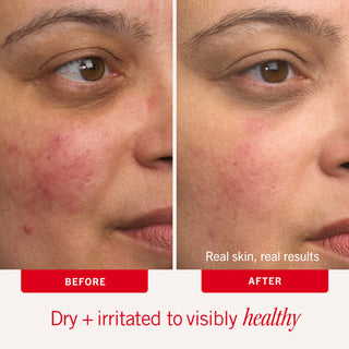Clear Up + Hydrate Trio